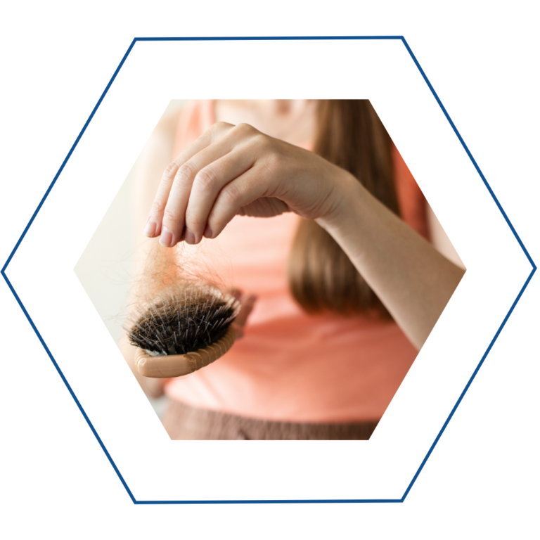 caduta capelli capelli che cadoto
